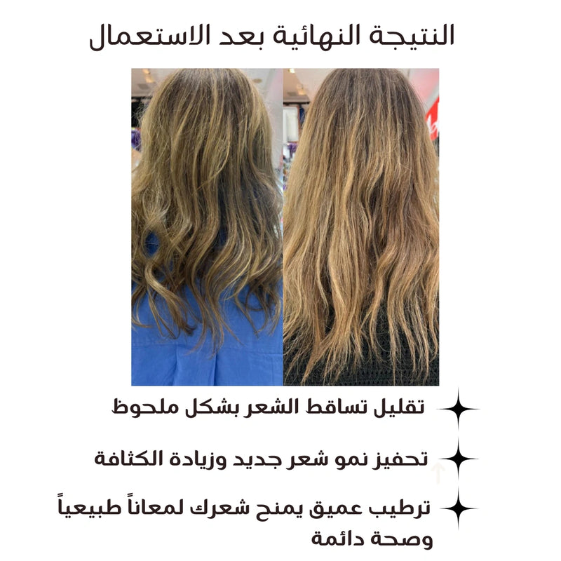 Varitry™ Anti-Chute Plus