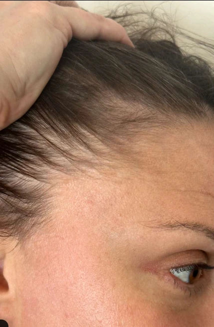 Cheveux avant traitement