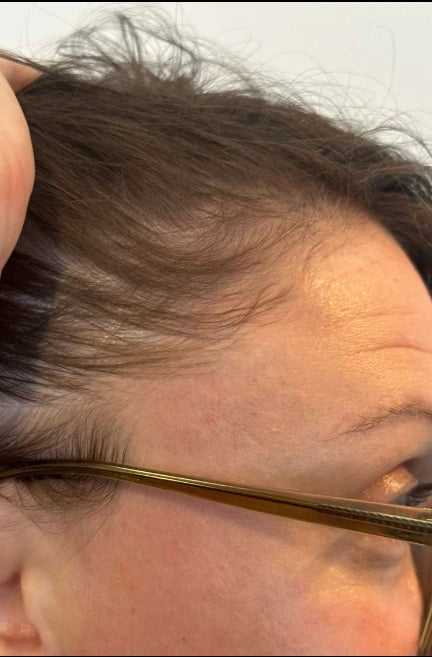 Cheveux après 30 jours de traitement